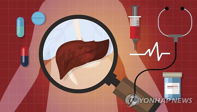 간질환 [게티이미지뱅크 제공]