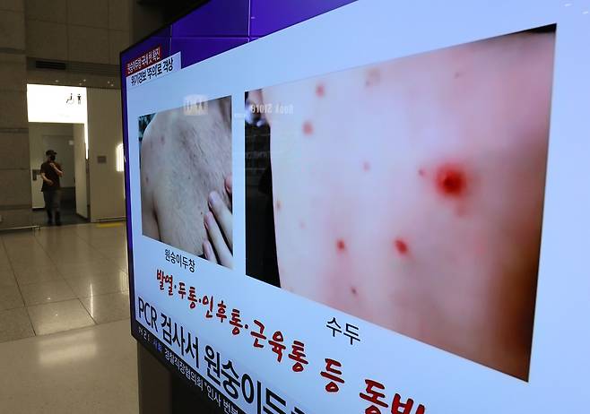 지난달 인천공항 제1터미널 입국장 TV에 원숭이두창 관련 뉴스가 나오고 있다. /뉴스1