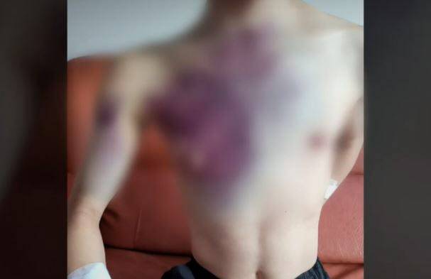 장애인 재활시설에서 근무하는 사회복지사가 입소 장애인을 폭행한 혐의로 경찰에 입건됐다. (사진=KBS 보도화면 캡처)