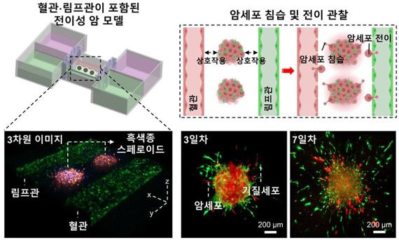 3D 바이오프린팅 기술로 만든 혈관·림프관이 포함된 체외 전이성 흑색종 모델에서 암세포의 침습과 전이 현상을 관찰할 수 있다. POSTECH 제공