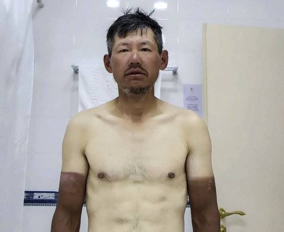 완주 직후의 박종하 씨. 피부 톤의 차이가 극명하다. 사진 박종하