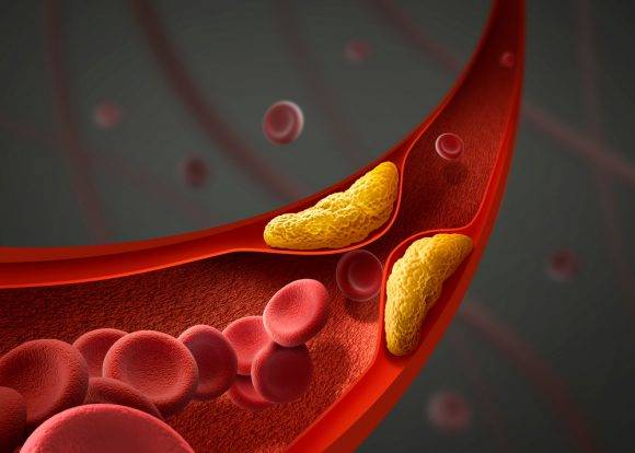 [사진=클립아트코리아]