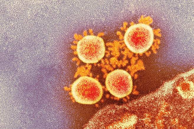 코로나19 바이러스의 전자현미경 사진./National Infection Service