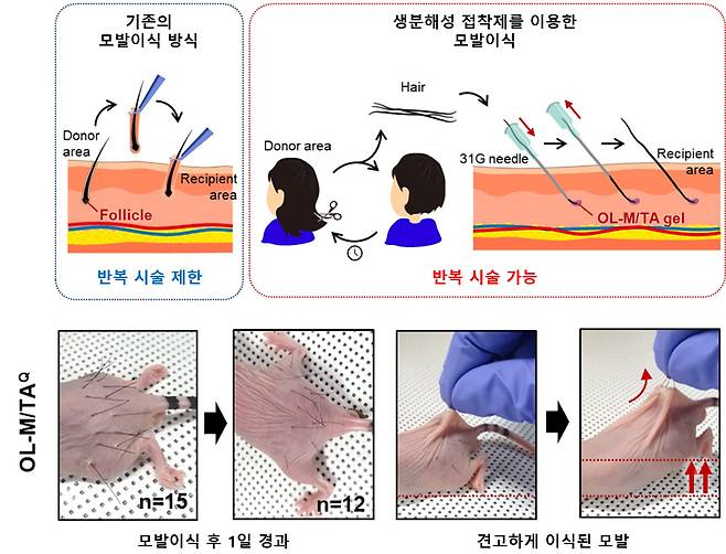기존 모발이식과 이번 개발 기술 모식도.[KAIST 제공]