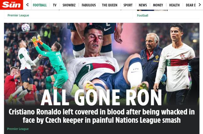 크리스티아누 호날두가 지난 24일(현지시간) 체코와의 UEFA 네이션스리그 조별예선에서 코부상을 당했다. 출처 | 더썬