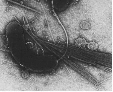 인간에게 치명적인 설사병을 일으키는 콜레라 세균, 비브리오 콜레라(Vibrio Cholerae)를 전자현미경으로 관찰한 모습. /사진=연합뉴스