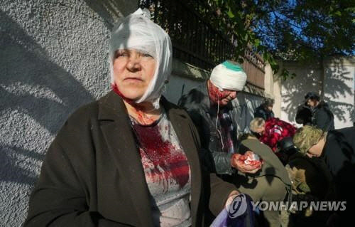 10일 미사일 공습으로 부상을 입은 우크라이나 키이우 시민들. [AP=연합뉴스]