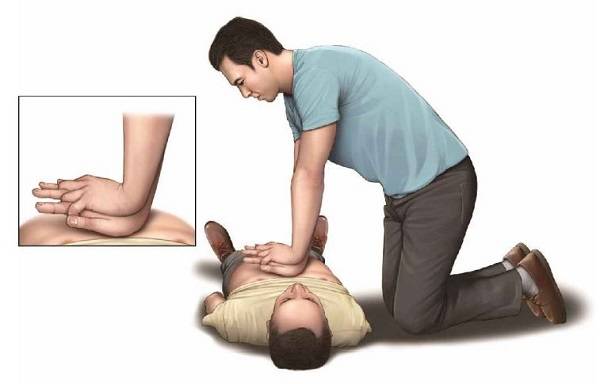 가슴압박 자세ㅣ출처: 2020년 한국심폐소생술 가이드라인