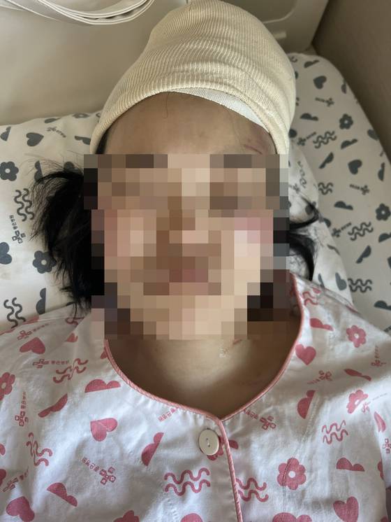 피해 여성 (사진제공: 피해자)