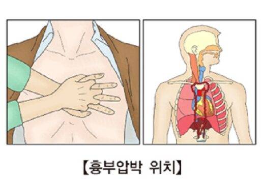 심폐소생술 시 가슴압박 위치 [자료=서울아산병원]