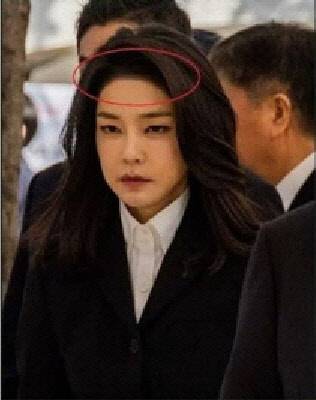 김건희 여사가 헤어라인 정리를 위해 흑채나 숯 등을 바른 것이라며 인터넷 커뮤니티에 올라온 사진. 인터넷 커뮤니티 화면 캡처.