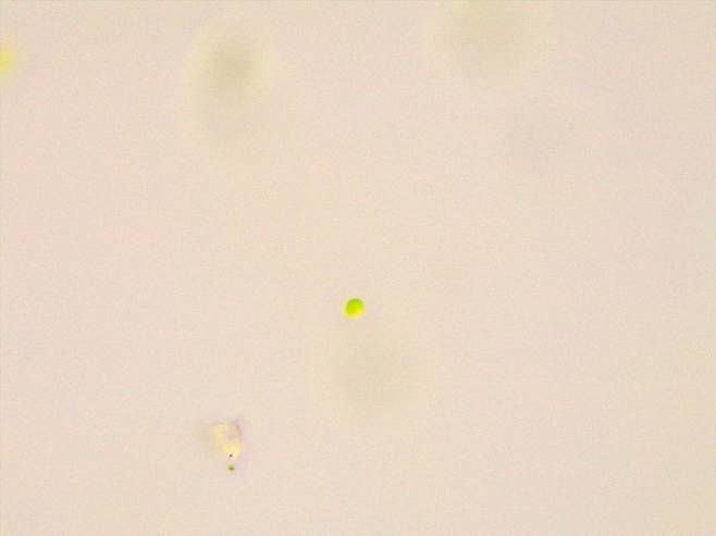 대구MBC가 대구 현풍읍 한 가정집 수돗물 필터에서 남세균이 검출됐다는 보도를 했을 당시, 수돗물 필터 시료를 부경대 이승준 교수팀이 현미경 검경배율 1000배로 확대해 찍었던 현미경 촬영본. 이 교수는 "살아있는 세포가 녹색을 띤다고 대구MBC 측에 설명한 적은 있으나, 현미경 상에서 보이는 녹색 둥근 물질이 '남세균'이라고 특정한 기억은 없다"고 본지에 밝혔다. /부경대 이승준 교수 제공