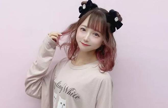 성형 후 미네소스 ⓒ 틱톡