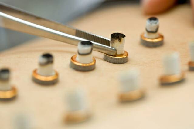 뜸치료는 유방암 치료후유증 중 하나인 림프부종 증상완화에 효과가 있는 것으로 분석됐다(사진제공=자생한방병원)