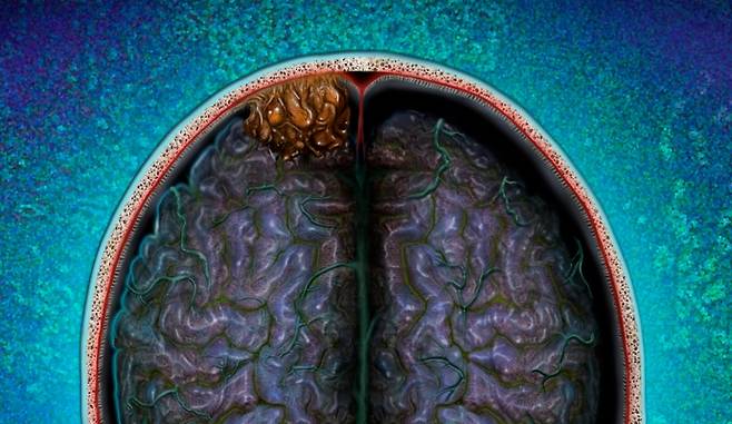 사진은 기사의 특정 사실과 관련 없음. 클립아트코리아