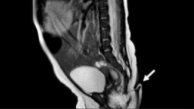 사진=아기의 MRI 영상