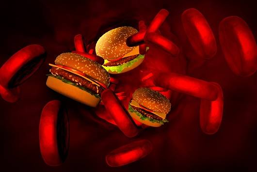 고지혈증은 그 자체로 특별한 증상이 없어 계속 관리가 필요하다ㅣ출처: 게티이미지 뱅크