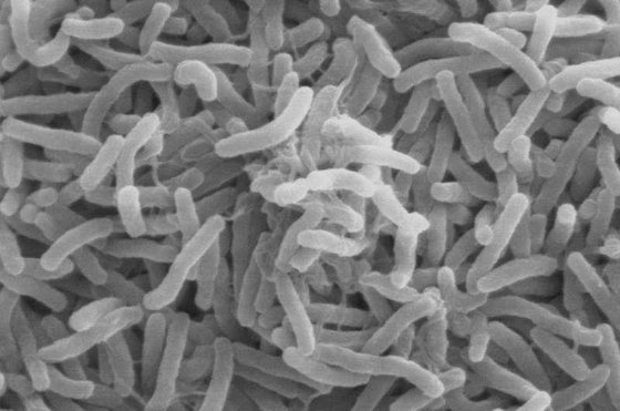 콜레라를 일으키는 비브리오 균(Vibrio cholerae) 균. [위키피디어]