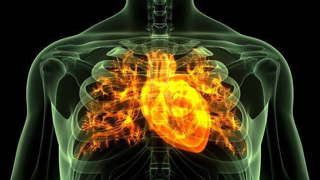 심정지로 사망선고를 받은 환자의 심장박동이&nbsp;돌아오는 '라자루스 증후군' 추정 사례가 국내에서 보고됐다. 게티이미지뱅크 제공