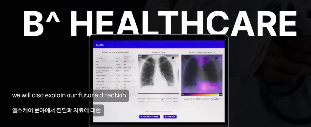 카카오브레인의 초거대AI 기반 의료영상 판독 서비스 '비헬스케어'. /카카오 유튜브 캡처