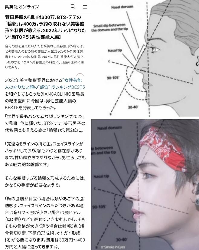 방탄소년단 뷔 얼굴 갖는데 4000만원? "완벽한 E라인"