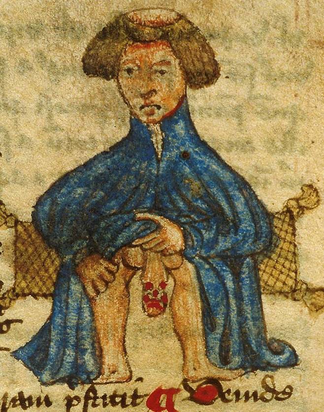 매독의 등장으로 매춘의 확산이 저지되기 시작했다.