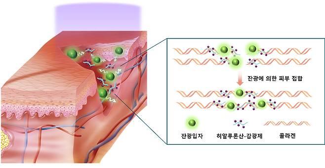 한세광 포항공대 교수 연구진이 빛을 내는 발광 입자를 활용해 피부의 상처를 접합하는 기술을 개발했다./포항공대