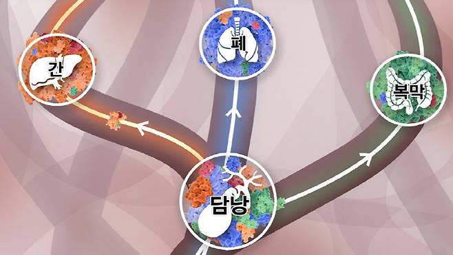 담낭에 다양한 클론들이 섞여 있다가 주황색 클론이 이긴 암세포는 간으로, 파란색 클론이 이긴 암세포는 폐로, 초록색 클론이 이긴 암세포는 복막으로 간다.