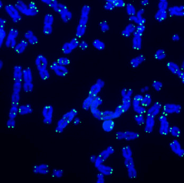 텔로미어는 염책체 끝 부분에 위치해 염색체를 보호한다. 손상된 DNA를 복구하는 작업을 하는 DNA(파란색)와 텔로미어(초록색)의 모습 (자료=솔크연구소)
