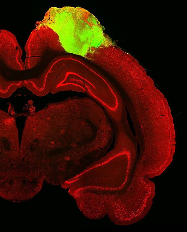 쥐의 뇌에 이식된 사람의 뇌 오가노이드(형광 부분) 모습. /미 펜실베이니아대