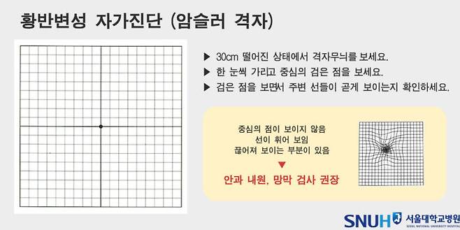 암슬러 격자를 활용한 황반변성 자가진단법. [자료=서울대병원]