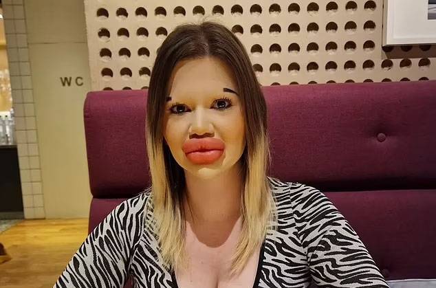 안드레아 이바노바가 필수 시술을 받은 후의 모습. / 사진=안드레아 이바노바 인스타그램