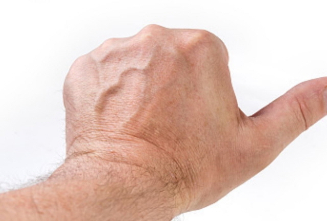 손등에 핏줄이 유독 도드라지게 튀어나왔다면 '손등정맥류'를 의심해볼 수 있다./사진=게티이미지뱅크
