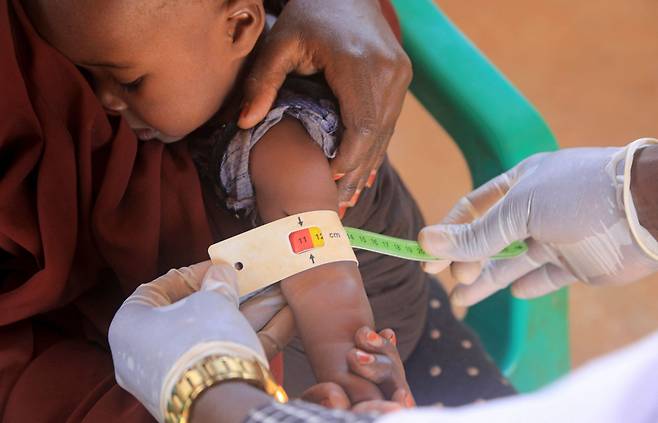 지난달 소말리아 북서부 바이도아 인근 마을에서 한 아이가 영양실조 검사를 받고 있다./로이터 연합뉴스