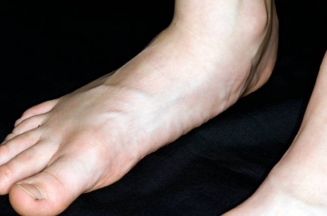 발의 아치가 무너지면 조금만 걸어도 발바닥이 아프니, 평소에 발가락과 아치 근육을 단련해 발이 평발이 되지 않게 해야 한다./사진=클립아트코리아