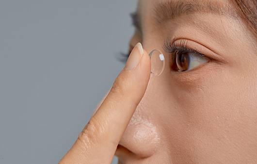 가시아메바 각막염은 콘택트렌즈 착용자에게 많이 발생하는 질환이다ㅣ출처: 게티이미지뱅크