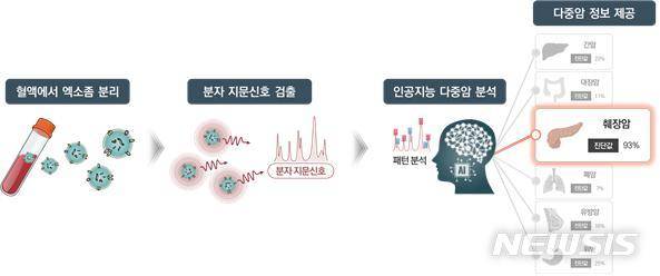 [서울=뉴시스] ﻿﻿국내 연구진이 혈액 속 '엑소좀'(세포 간 정보교환·신호전달 메신저), 빛 알갱이가 물질을 통과할 때 나타나는 고유한 스펙트럼으로 암을 빠르고 정확히 진단할 수 있는 '라만신호'(분자 지문 신호), 인공지능(AI) 분석 기술을 결합해 피 한방울로 폐암·췌장암·유방암·대장암·위암·간암 등 암 6종을 97%의 정확도로 동시에 조기진단할 수 있는 기술을 개발했다. (그래픽= 고려대구로병원 제공) 2023.03.28. photo@newsis.com.