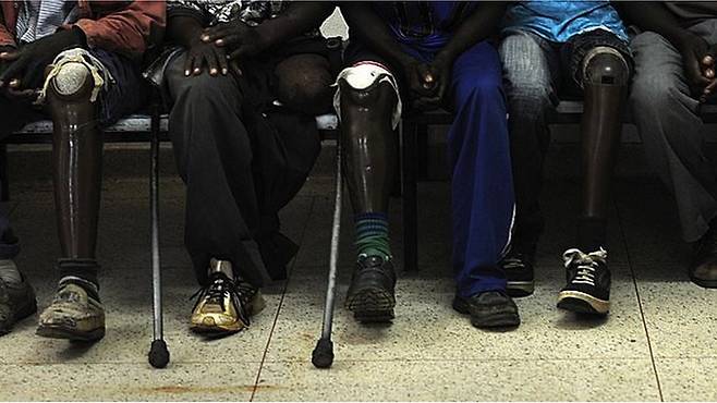 지뢰와 폭발하지 않은 무기로 삶을 바꾸는 부상을 입은 사람들은 장애가 있는 모든 앙골라 사람들의 70%를 차지한다