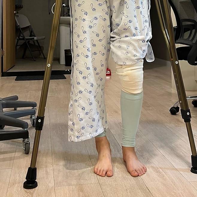 수술 직후 이유빈의 다리 상태 [이유빈 제공. 재배포 및 DB 금지]