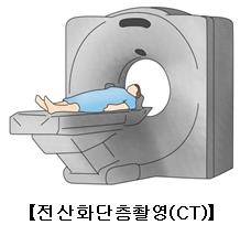 CT [출처: 서울아산병원]