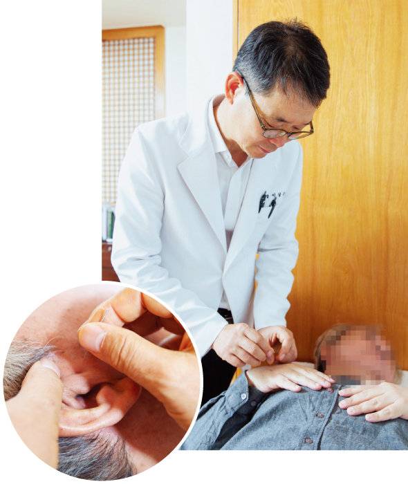 이상곤 갑산한의원 원장이 이명 환자에게 보사침법으로 침을 놓고 있다. 원 안은 이명 치료를 위해 침을 놓은 귀 옆의 청궁혈 혈자리이다.