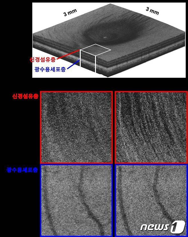 넓은 영역에 걸친 3차원 전부분 세포수준 고해상도 망막 이미징. (KAIST 제공) /뉴스1