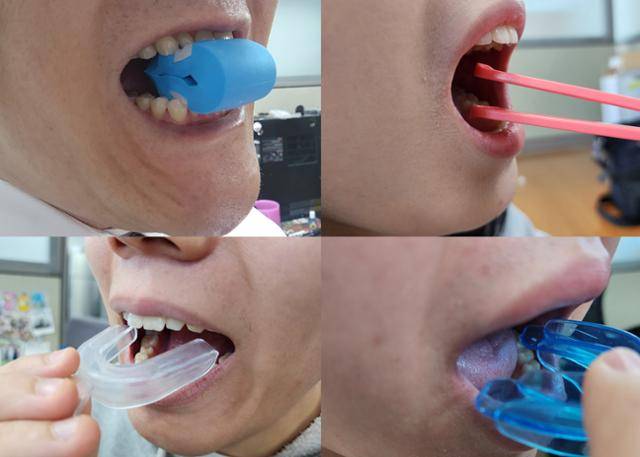 최근 이중턱을 없애주고 얼굴형까지 브이라인으로 만들어준다는 기구가 인기를 끌고 있다. 하지만 대부분 제품들은 의학적으로나 과학적으로 검증되지 않는 제품들이다. 김민규 기자