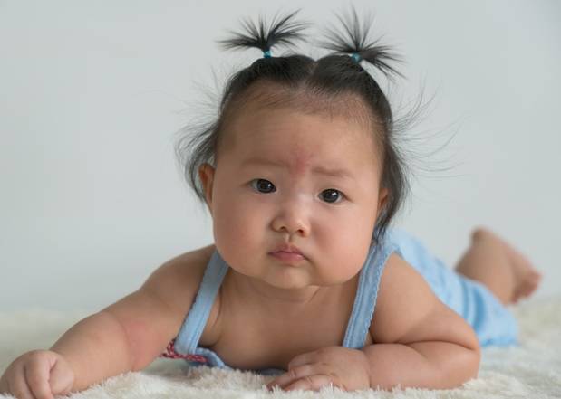 연어반은 생후 1~3년 이후 대부분 저절로 없어지므로 걱정하지 않아도 된다./사진=게티이미지뱅크