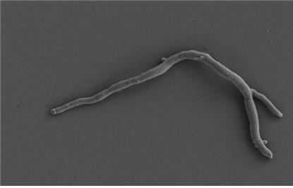 항암 효과 확인된 마이크로모노스포라(Micromonospora)속 신종 방선균(MS-62) [환경부 제공. 재판매 및 DB 금지]