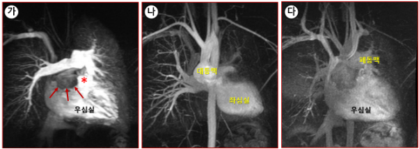 (가) 우심실에서 나가는 대동맥(화살표)과 폐동맥(별표).(나) 좌심실에서 나가는 대동맥.(다) 우심실에서 나가는 폐동맥.