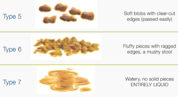 '브리스툴 스툴 스케일' 유형 5~7. / 사진=Continence Foundation of Australia 홈페이지