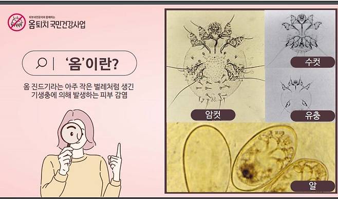 옴 진드기의 형체. 대한피부과학회 제공