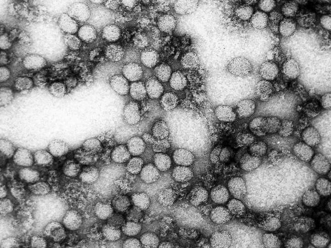 황열바이러스. 위키미디어 제공