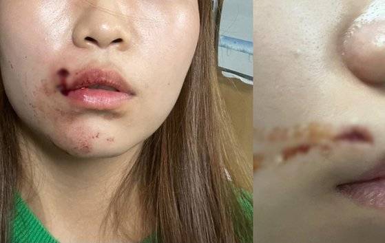 최근 온라인 커뮤니티에는 ″대전의 한 가게에서 자신의 20대 딸이 무차별 폭행을 당했다″고 주장하는 글이 올라왔다. 사진 온라인 커뮤니티